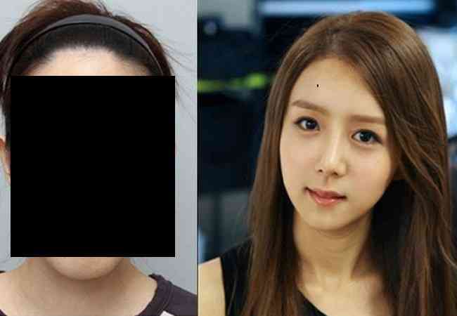 韓国の整形のビフォー アフターが相変わらずスゴイ ﾟdﾟ ガールズちゃんねる Girls Channel