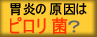 ピロリ菌は胃癌の原因　胃癌の内視鏡検診