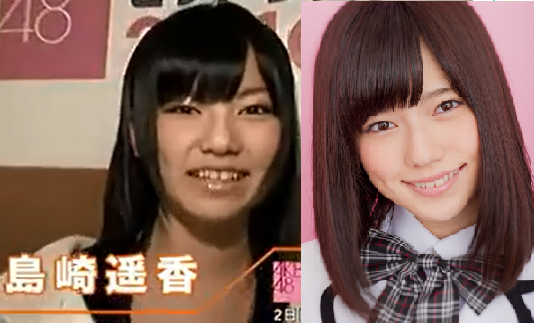 AKB48ぱるること島崎遥香が茶髪でビッチ化