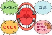 ドライマウスの方