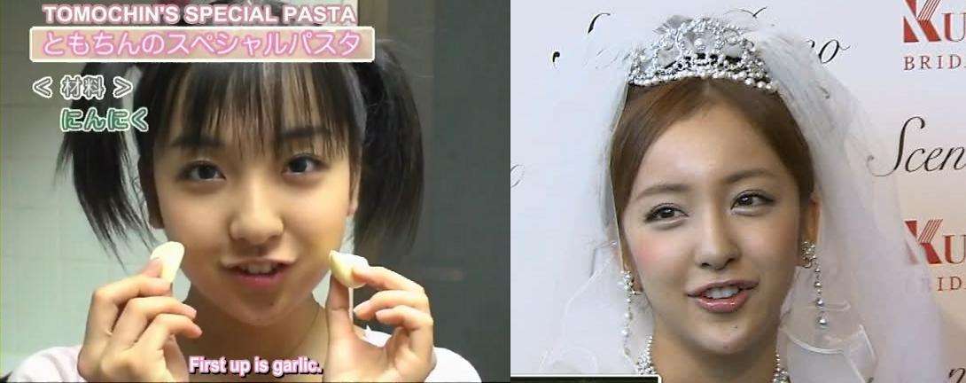 元AKB48板野友美さんの強烈なファンが「ともちんのアゴが変になっている」と泣く