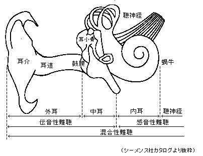 聴覚障害の基礎知識