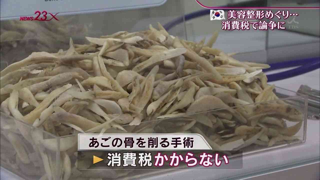 韓国の整形すごすぎｗ