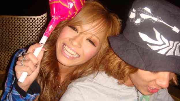 小森純、スナック菓子を食べて歯がかける「歯だけは綺麗って褒め続けられて生きてきただけに相当ショック」