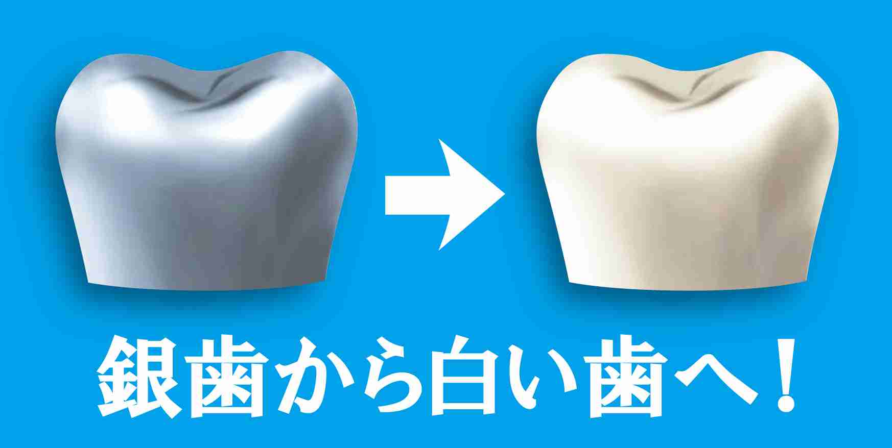 銀歯ある子のことどう思いますか？