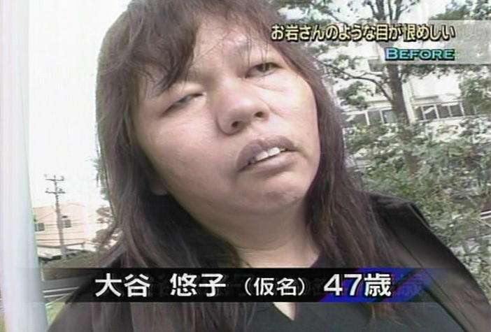 お金があったら整形しますか？