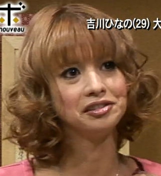 沢尻エリカ(28)の最新画像の口元が酷いと話題に