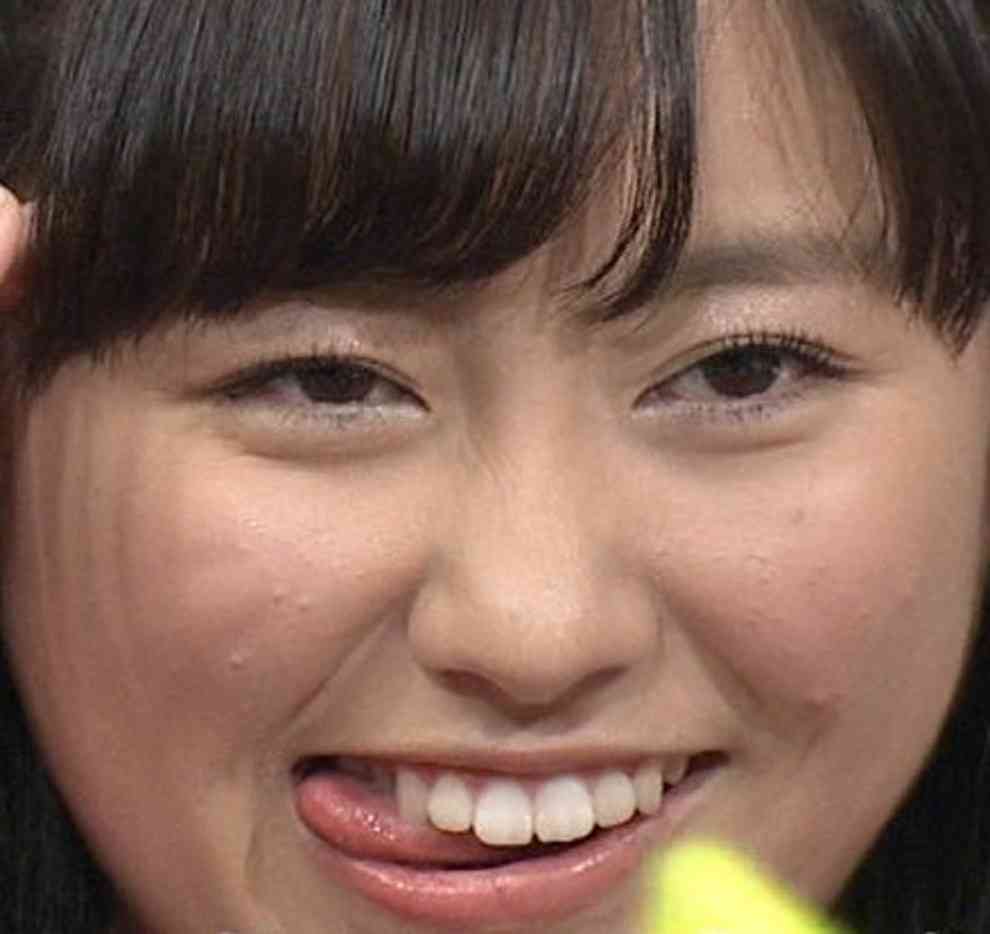 元ももクロ・早見あかりの顔がパンパンになってる件