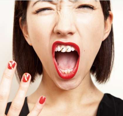 歯にタトゥーをほどこす“歯タトゥー”が海外で人気らしい
