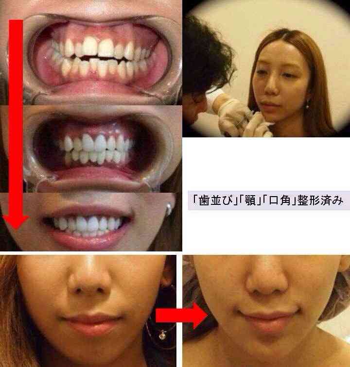 ざわちん、SMAPものまねメイクは「予想以上のクオリティー」出演を振り返る