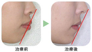 歯の矯正悩んでる方いませんか？