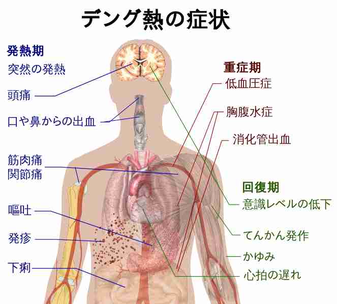 デング熱、新たに２人国内感染＝同じ学校の20代男女－東京・代々木公園で感染か