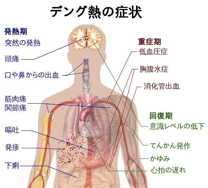 デング熱、新たに２人国内感染＝同じ学校の20代男女－東京・代々木公園で感染か