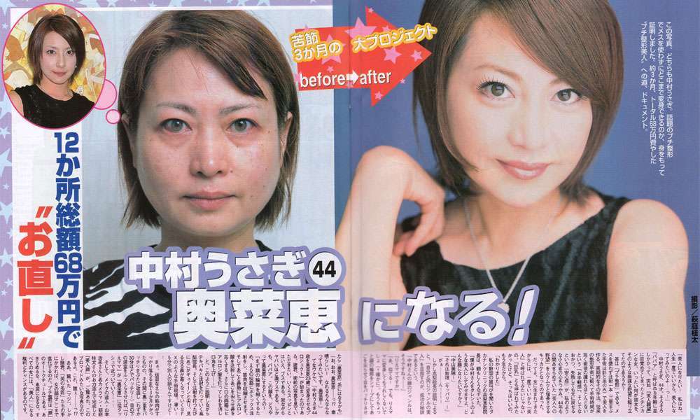 杉浦太陽、辻希美が抗生剤によるアナフィラキシーショックでICU入りした過去を告白