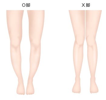 X脚について。
