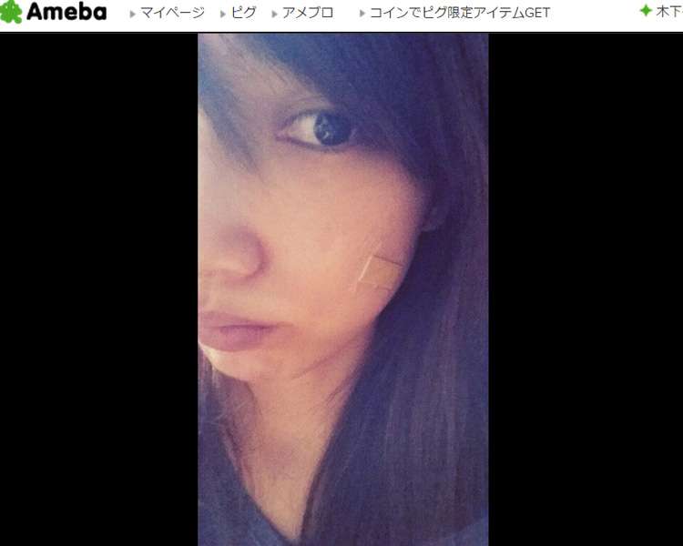 後藤真希、顔のやけどが悪化「ぐじゅ。。っとしてた」 - シネマトゥデイ