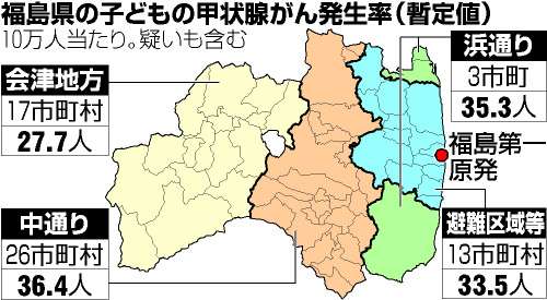 甲状腺がん、疑い含め１０４人　福島の子供３０万人調査