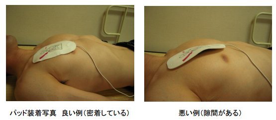【とんだ災難】重体の女性にAEDを取り付けようと服を切る→痴漢扱いで事情聴取