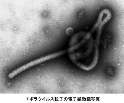 【エボラ出血熱】 政府、西アフリカへの自衛隊派遣の検討着手 緊急医療チームなど
