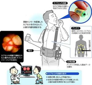 注射が苦手な人に朗報！代わりに「小さな針がたくさんついたカプセル」を飲むだけで大丈夫