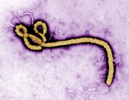 【朗報】エボラ出血熱の疑いで隔離された日本人2人、感染なしを確認！