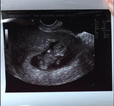 優木まおみ、6カ月長女の顔写真を公開「成長記録も兼ねていきたい」