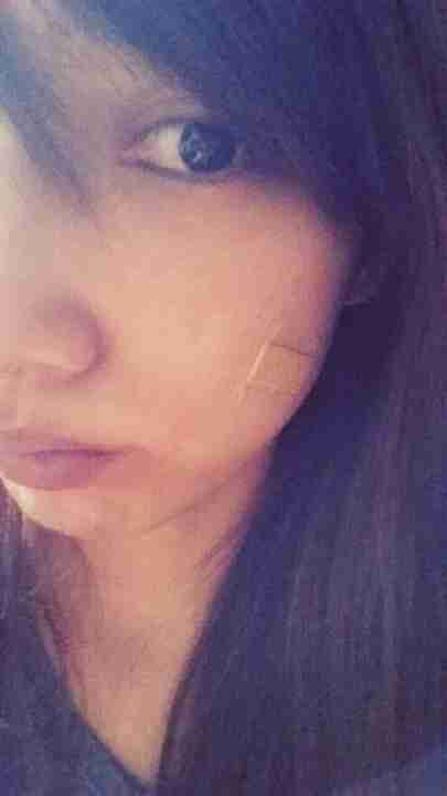 後藤真希 顔のやけどが悪化 ガールズちゃんねる Girls Channel