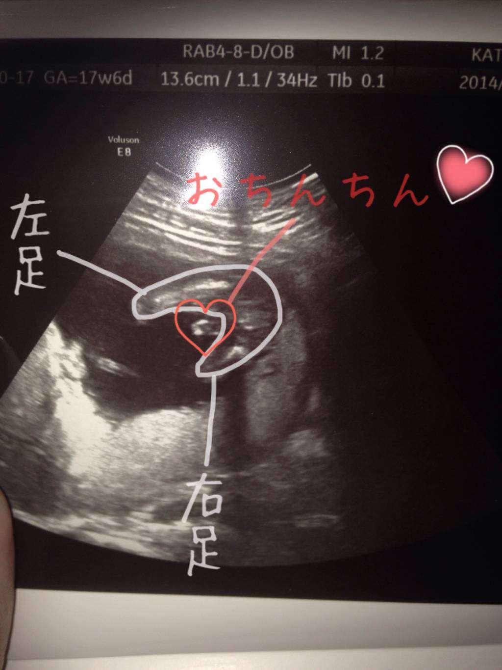 妊娠中の16歳モデル堀鈴香　エコー写真を披露「男の子でした！」　母体を考慮した新ヘアも