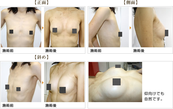 谷間はそうそうできません！「男性は女子の胸のことをわかっていないなぁ」と思うことって？