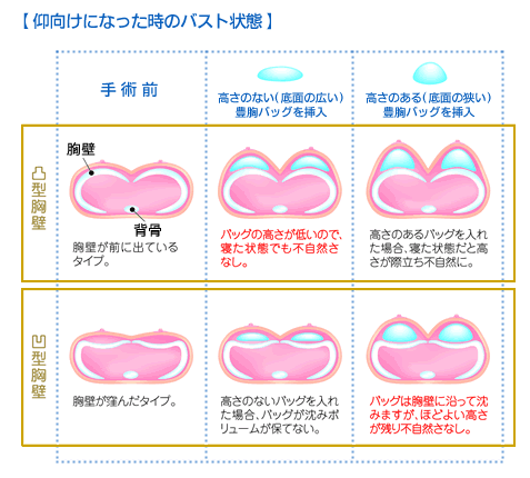 谷間はそうそうできません！「男性は女子の胸のことをわかっていないなぁ」と思うことって？