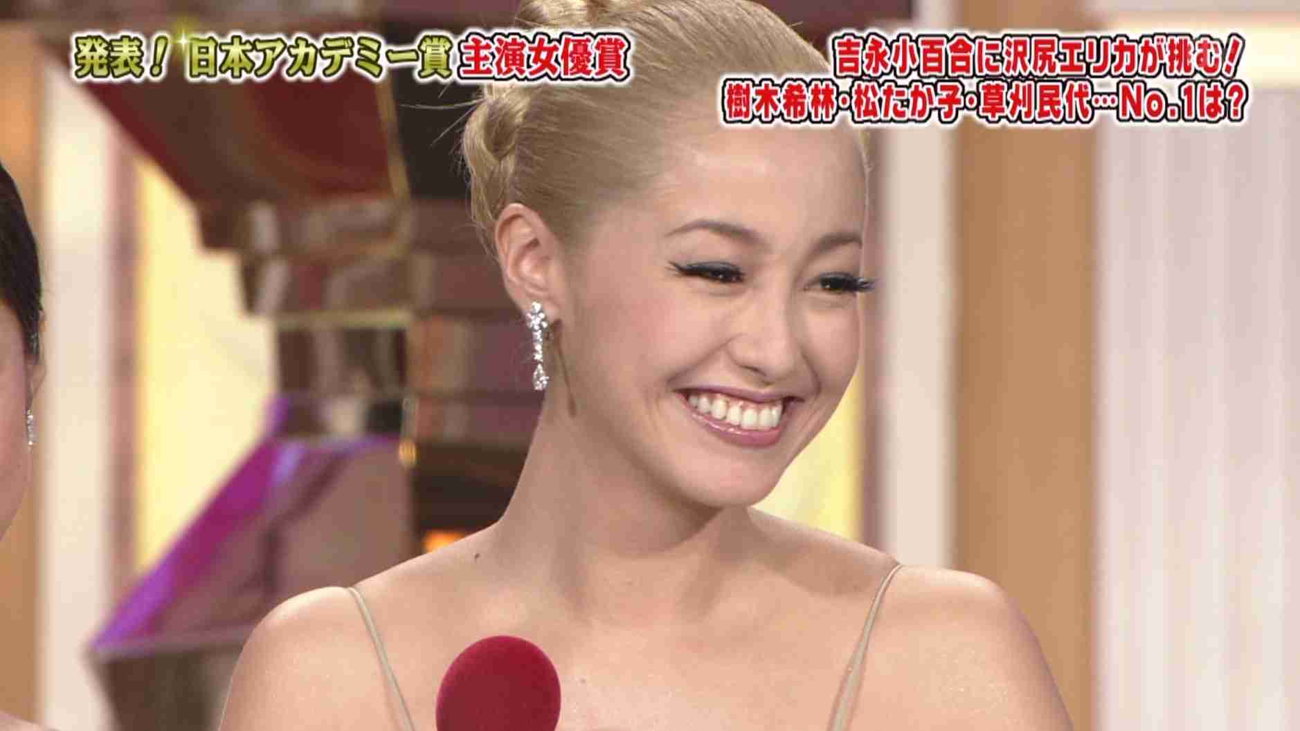 口元をいじったせいで残念になった芸能人は？