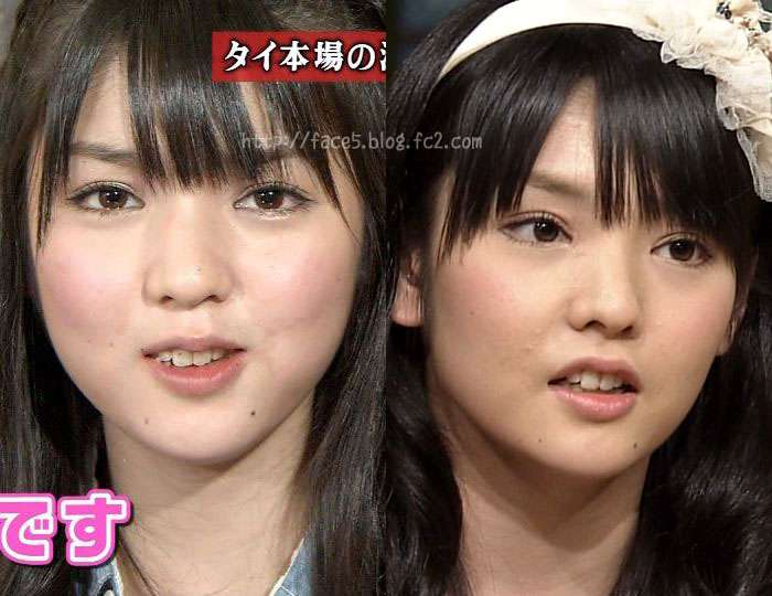 逆に整形してよかったじゃんと思う芸能人は？