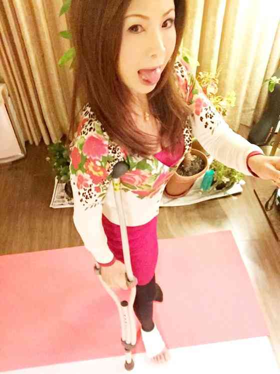 シルク、右足中足骨の亀裂骨折で全治1か月！縄跳びでトレーニング中「やっちまった…」