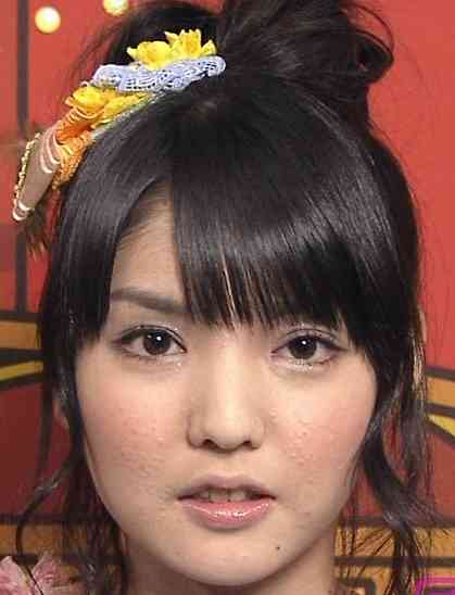 逆に整形してよかったじゃんと思う芸能人は？