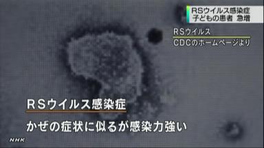 小さな子供は注意！特効薬がないRSウイルス、過去最悪のペースで感染者が急増