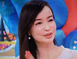 口元をいじったせいで残念になった芸能人は？