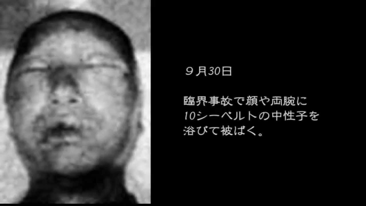 【閲覧注意】　東海村JCO臨界事故　放射能の恐怖 - YouTube