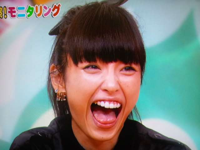 口元をいじったせいで残念になった芸能人は？