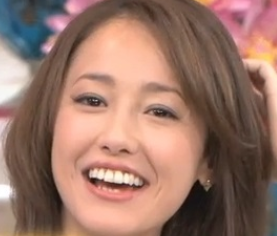 口元をいじったせいで残念になった芸能人は？