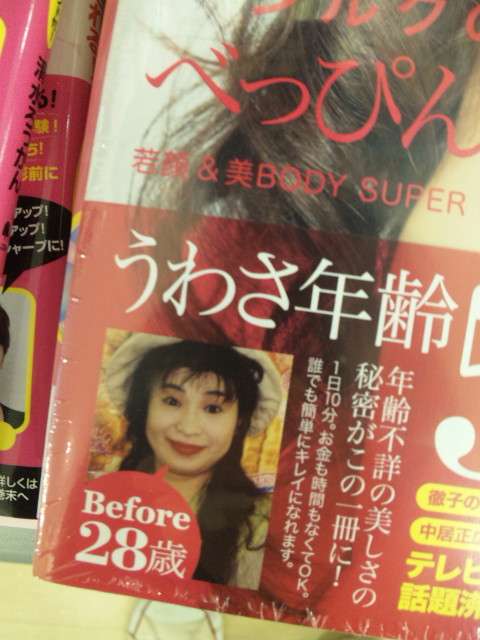 シルク、右足中足骨の亀裂骨折で全治1か月！縄跳びでトレーニング中「やっちまった…」