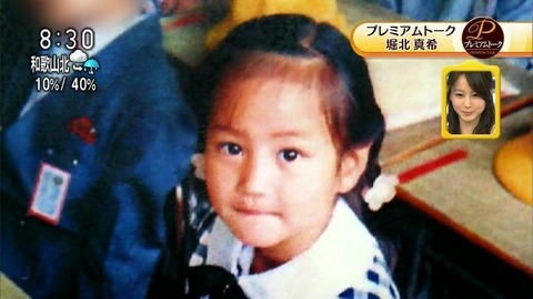 逆に整形してよかったじゃんと思う芸能人は？