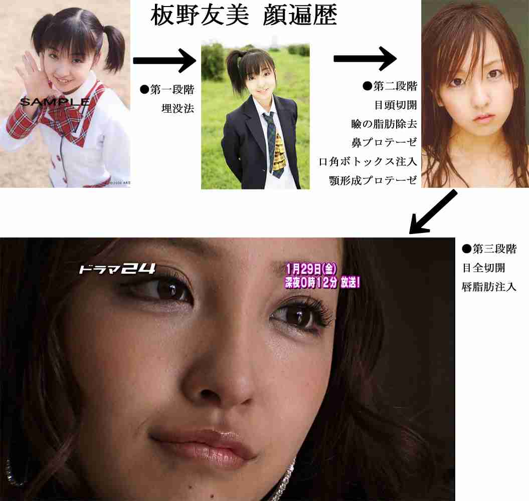整形した人集合