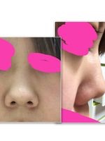 豚鼻な方