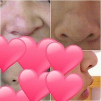 豚鼻な方