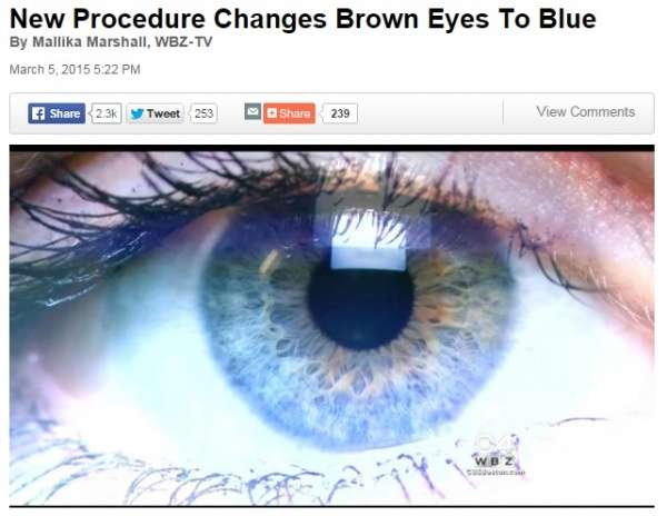 レーザーによりブルーの瞳を手に入れる!?米国でもすでに実験段階。