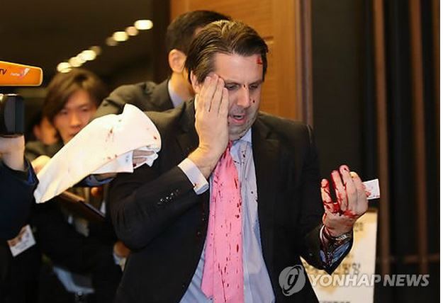 米国大使、謎の男に襲撃され大怪我（※二次追記：「犯人は独島関連団体の代表」など｜シンシアリーのブログ