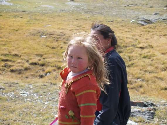 レーザーによりブルーの瞳を手に入れる!?米国でもすでに実験段階。