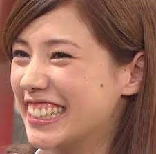 ガミースマイルさんお集まりください