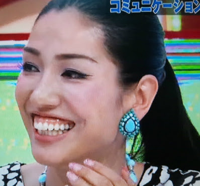 ガミースマイルさんお集まりください