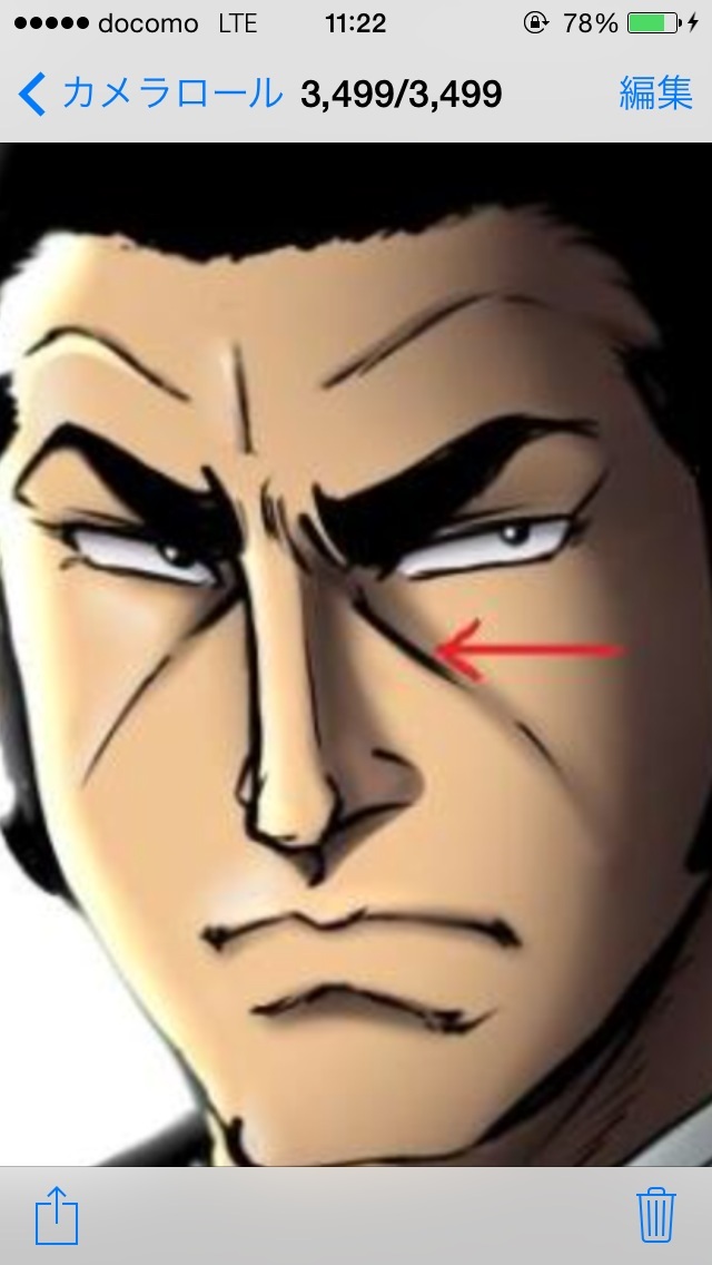 ゴルゴ線どうしてますか？